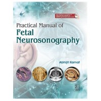 Practical Manual of Fetal Neurosonography;1st Edition 2027 by Abhijit Kamat