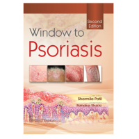 Window to Psoriasis;2nd Edition 2022 by Sharmila Patil & Ratnakar Shukla
