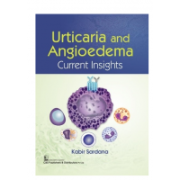 Urticaria And Angioedema: Current Insights; 1st Edition 2022 By Kabir Sardana