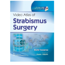 Video Atlas Of Strabismus Surgery;1st edition 2022 By Rohit Saxena