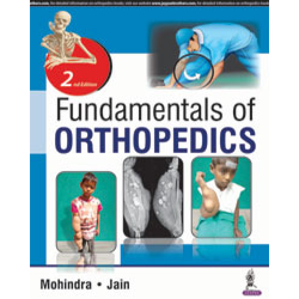 Fundamentals of Orthopedics;2nd Edition 2018 By Mukul Mohindra & Jitesh Kumar Jain