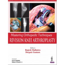 Mastering Orthopedic Techniques Revision Knee Arthroplasty;1st Edition 2019 By Rajesh Malhotra & Deepak Gautam